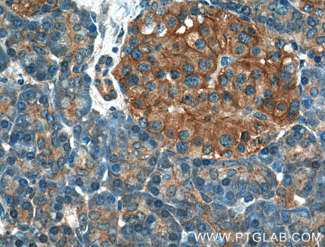 GNAS Antibody in Immunohistochemistry (Paraffin) (IHC (P))