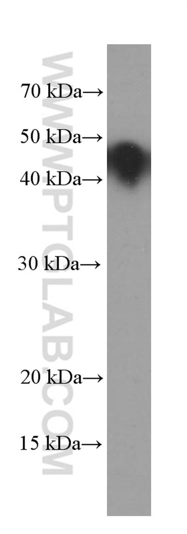 GNAS Antibody in Western Blot (WB)