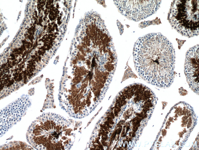 AKAP3 Antibody in Immunohistochemistry (Paraffin) (IHC (P))