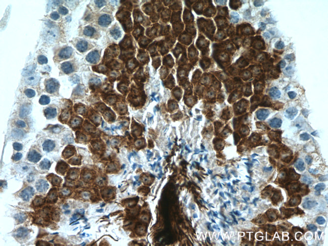 AKAP3 Antibody in Immunohistochemistry (Paraffin) (IHC (P))