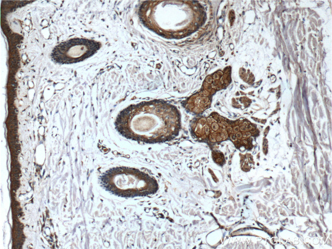 CD1d Antibody in Immunohistochemistry (Paraffin) (IHC (P))