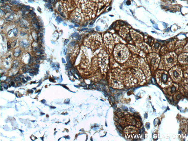 CD1d Antibody in Immunohistochemistry (Paraffin) (IHC (P))