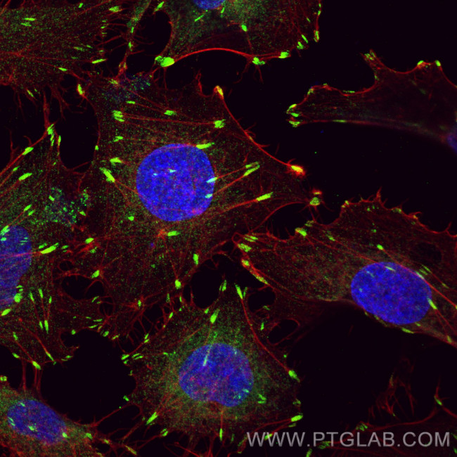 FAK Antibody in Immunocytochemistry (ICC/IF)