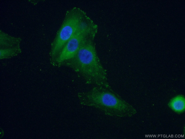 FAK Antibody in Immunocytochemistry (ICC/IF)