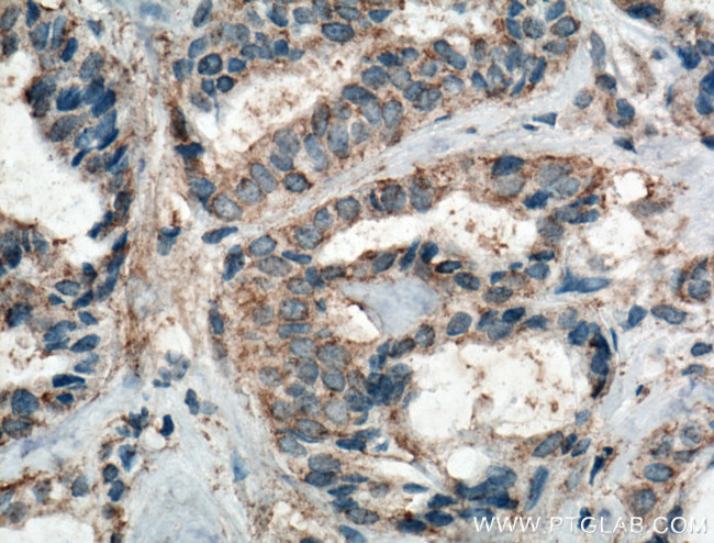 FAK Antibody in Immunohistochemistry (Paraffin) (IHC (P))