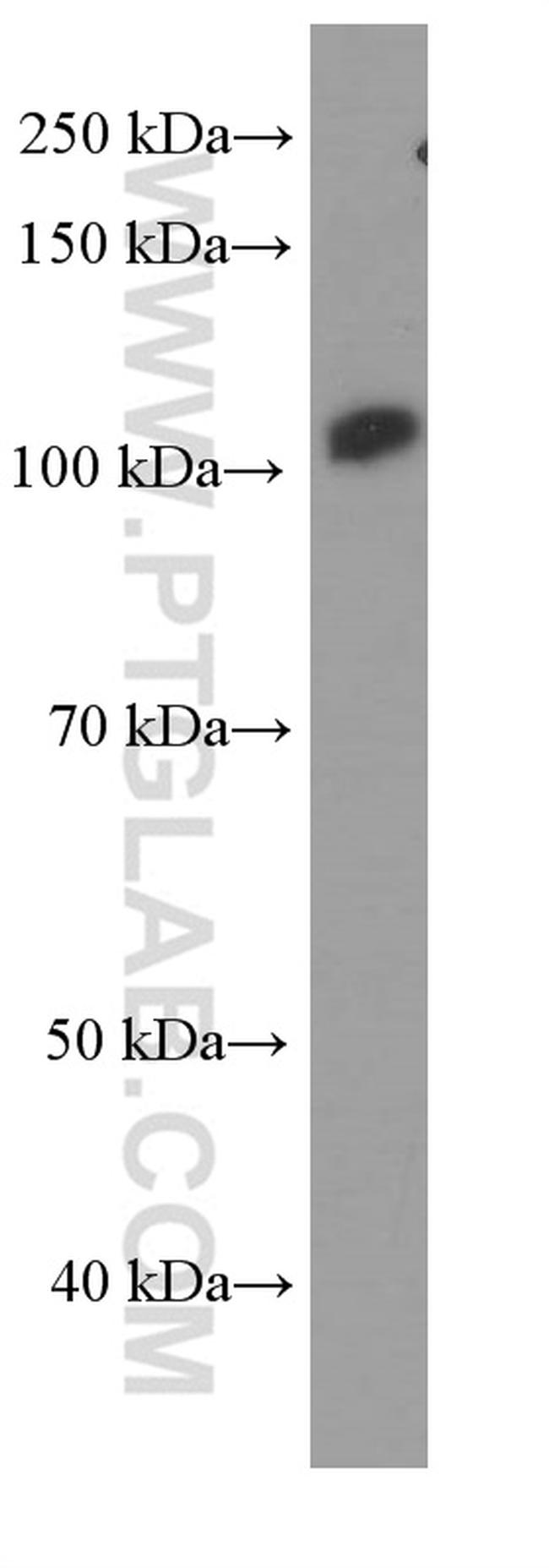 FAK Antibody in Western Blot (WB)