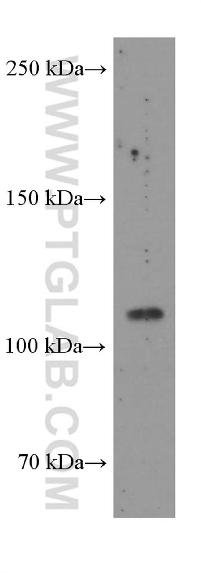 FAK Antibody in Western Blot (WB)