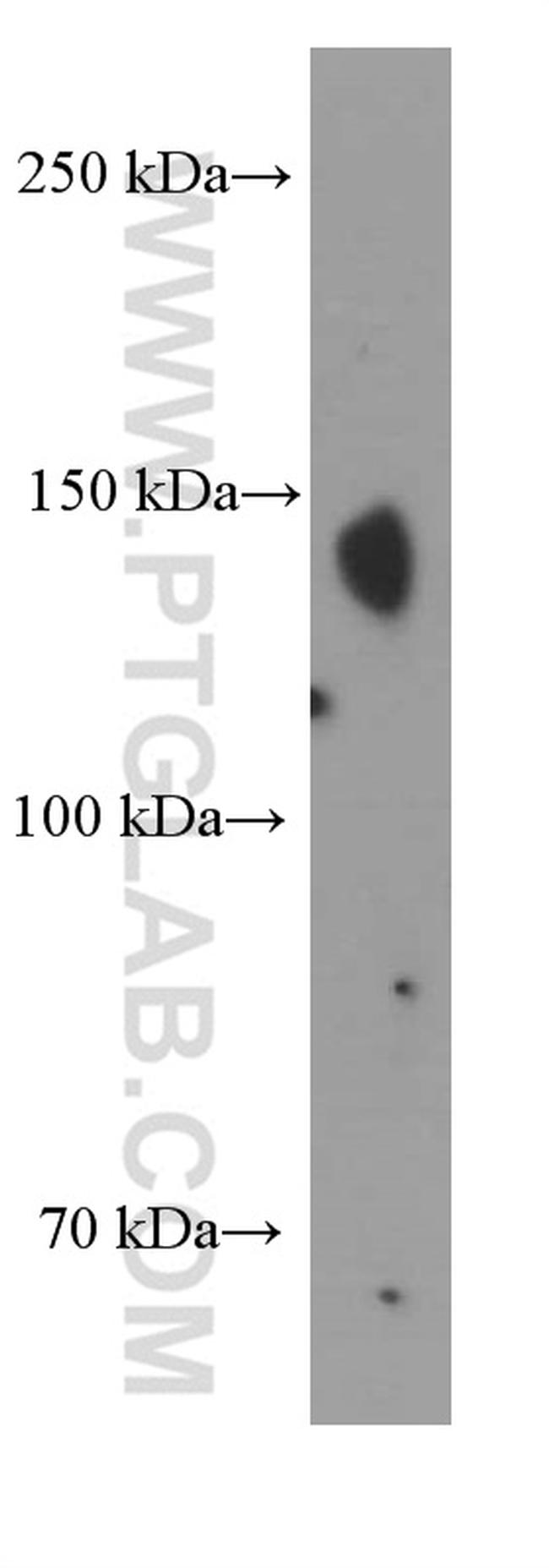 Nestin Antibody in Western Blot (WB)