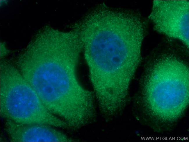 alpha-1B-glycoprotein Antibody in Immunocytochemistry (ICC/IF)