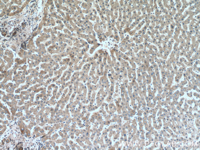 alpha-1B-glycoprotein Antibody in Immunohistochemistry (Paraffin) (IHC (P))