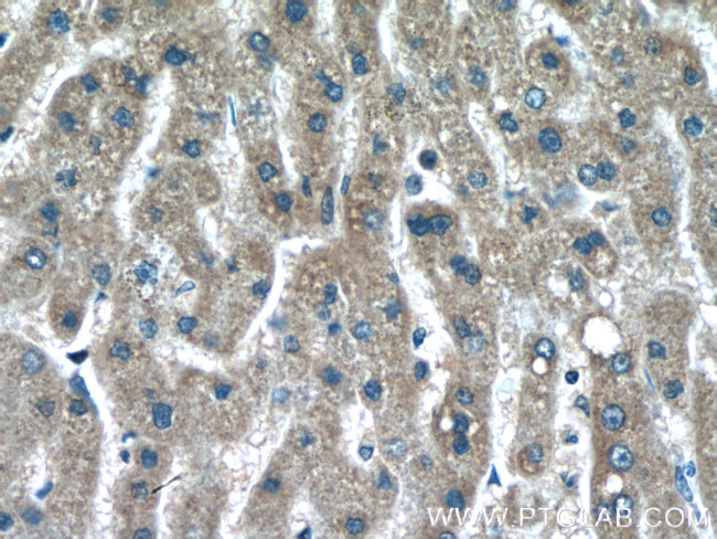 alpha-1B-glycoprotein Antibody in Immunohistochemistry (Paraffin) (IHC (P))