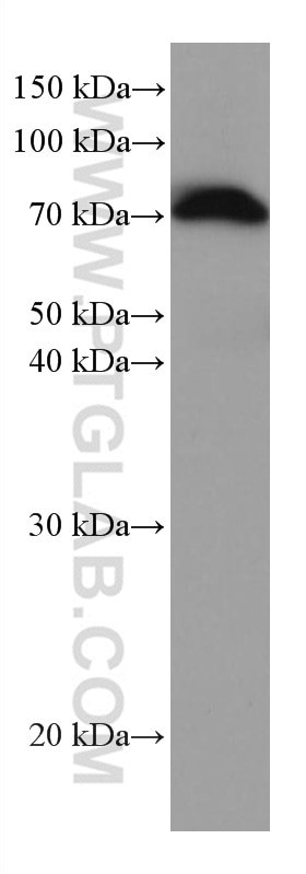 alpha-1B-glycoprotein Antibody in Western Blot (WB)