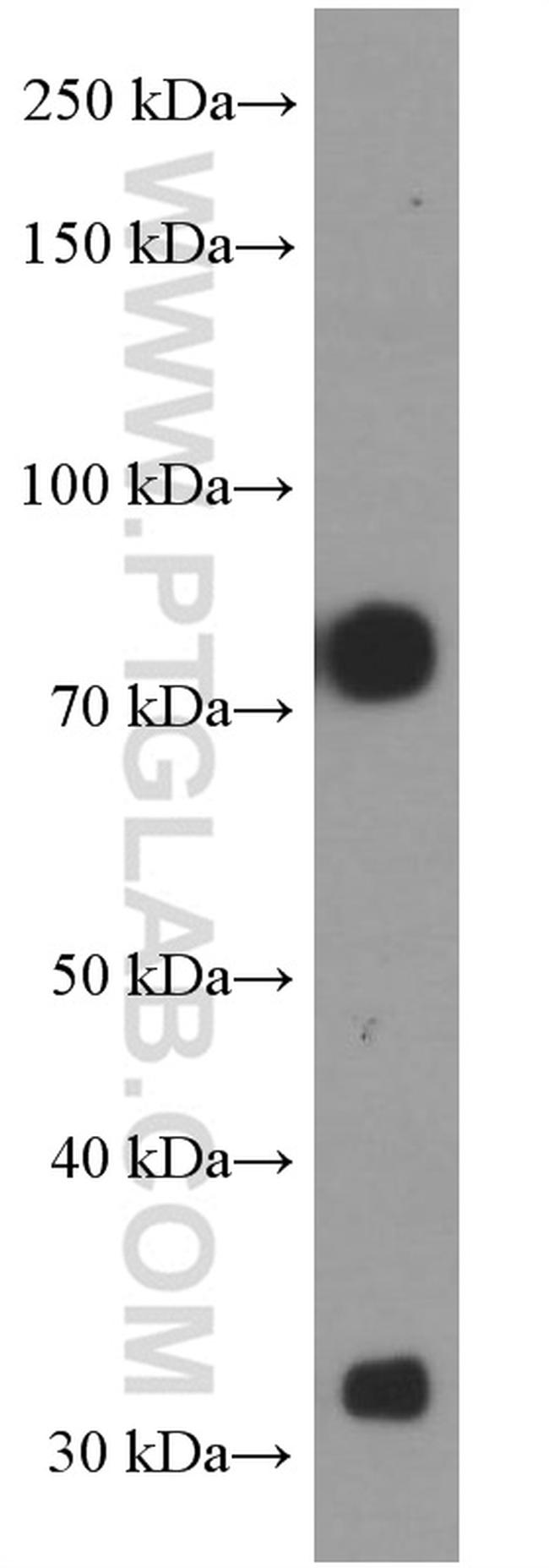 alpha-1B-glycoprotein Antibody in Western Blot (WB)