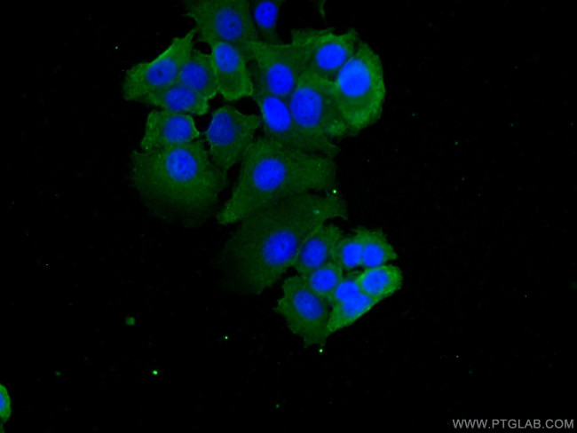 FRS2 Antibody in Immunocytochemistry (ICC/IF)