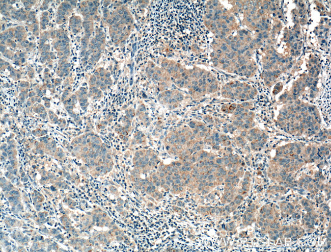 FRS2 Antibody in Immunohistochemistry (Paraffin) (IHC (P))