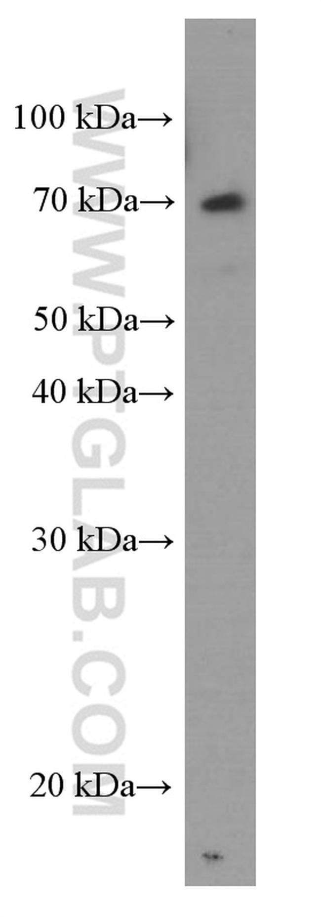 FRS2 Antibody in Western Blot (WB)