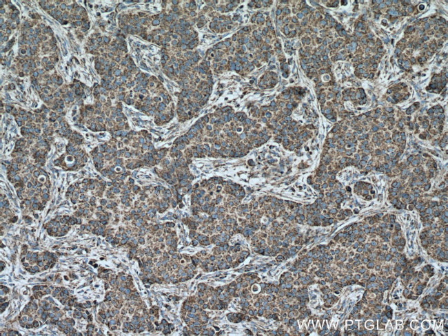 Cytochrome c Antibody in Immunohistochemistry (Paraffin) (IHC (P))