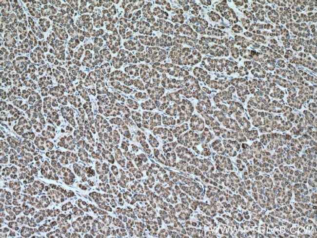 Cytochrome c Antibody in Immunohistochemistry (Paraffin) (IHC (P))