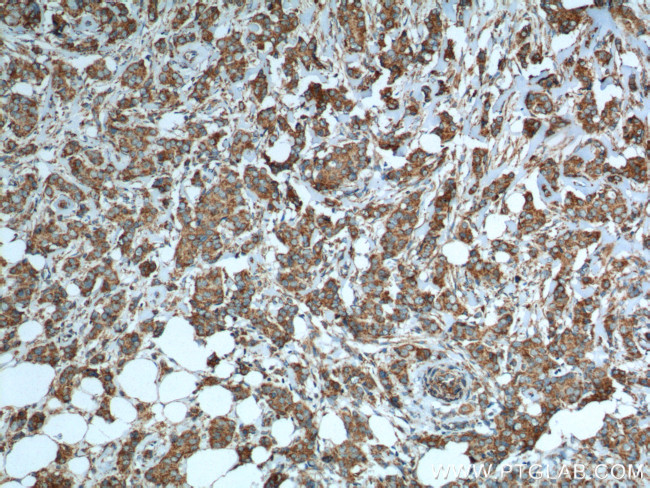 Cytochrome c Antibody in Immunohistochemistry (Paraffin) (IHC (P))