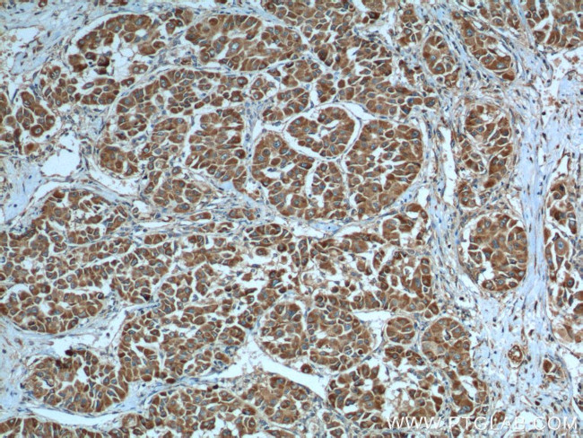 Cytochrome c Antibody in Immunohistochemistry (Paraffin) (IHC (P))