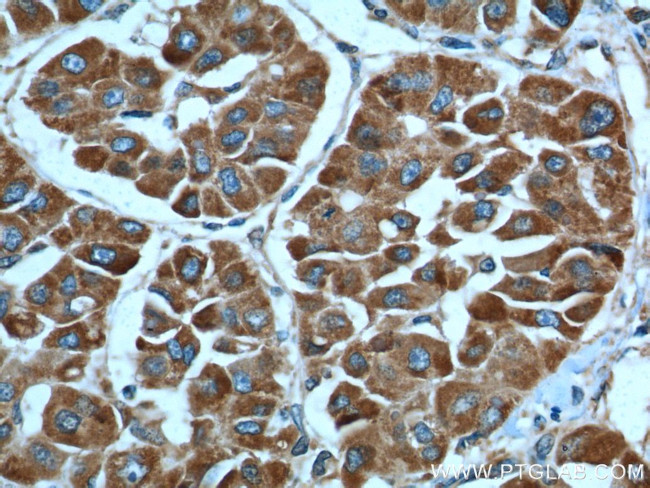 Cytochrome c Antibody in Immunohistochemistry (Paraffin) (IHC (P))