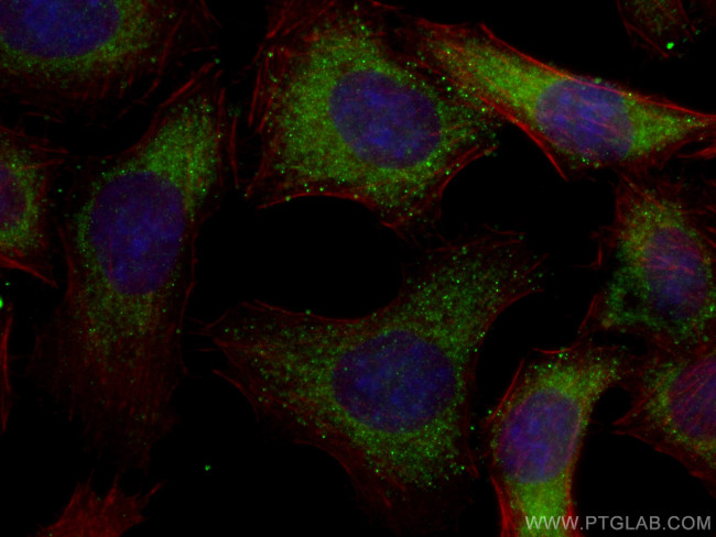 GLS Antibody in Immunocytochemistry (ICC/IF)