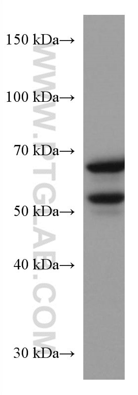 GLS Antibody in Western Blot (WB)