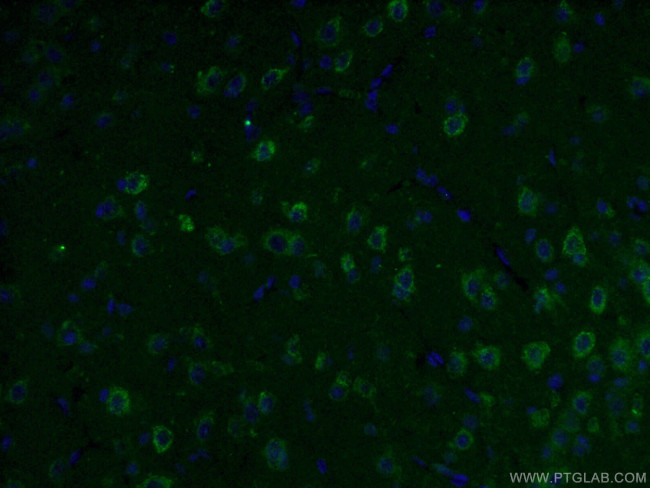 GLS Antibody in Immunohistochemistry (PFA fixed) (IHC (PFA))