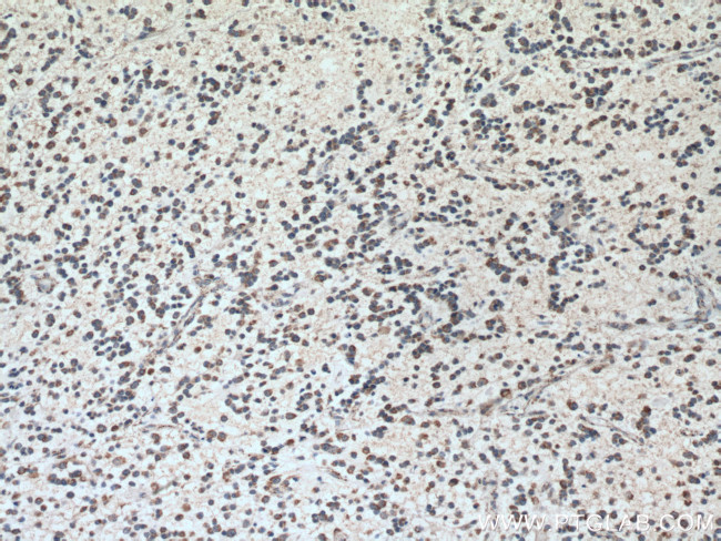 GLS Antibody in Immunohistochemistry (Paraffin) (IHC (P))