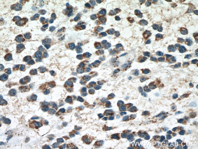 GLS Antibody in Immunohistochemistry (Paraffin) (IHC (P))