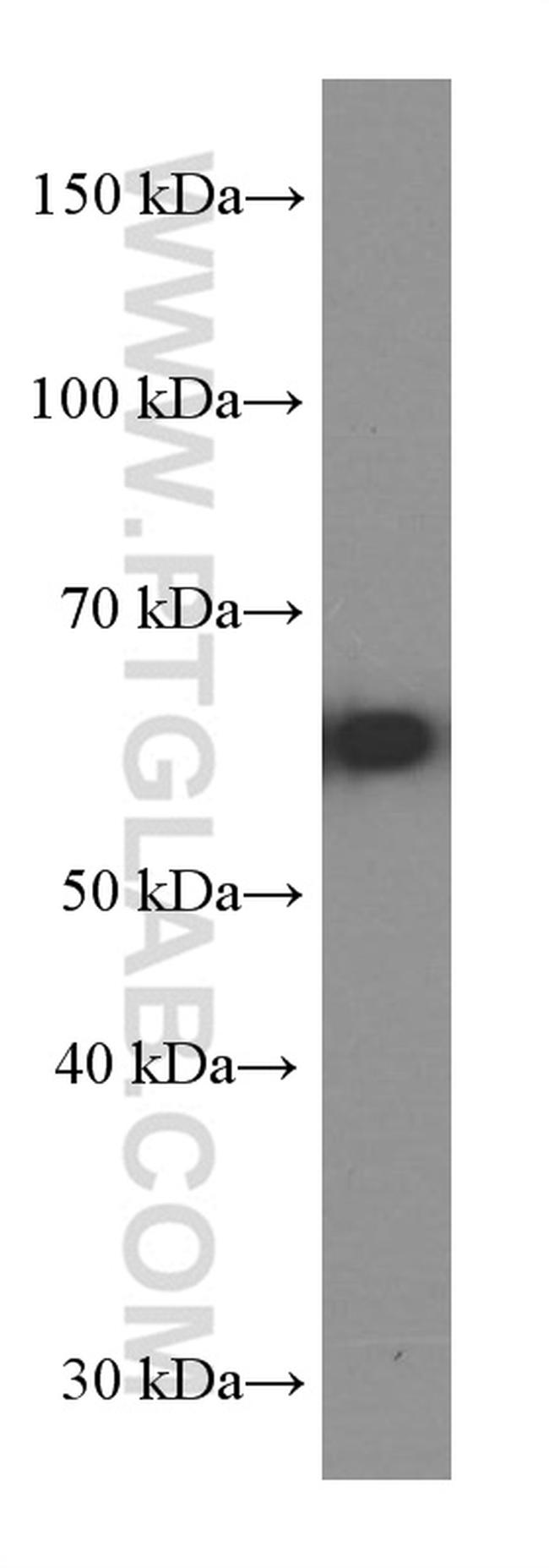 GLS Antibody in Western Blot (WB)