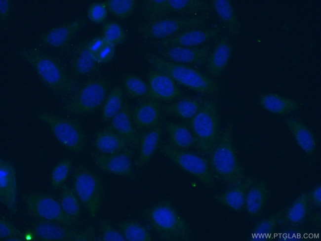 GLS Antibody in Immunocytochemistry (ICC/IF)