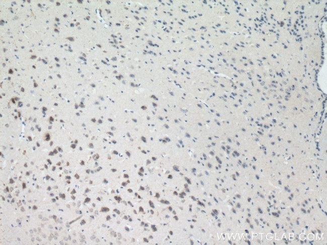 GLS Antibody in Immunohistochemistry (Paraffin) (IHC (P))