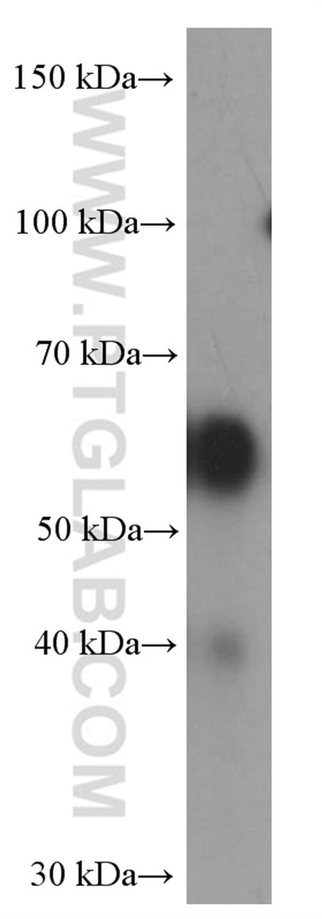 GLS Antibody in Western Blot (WB)