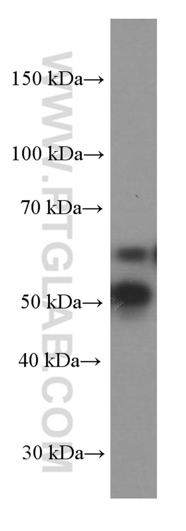 GLS Antibody in Western Blot (WB)