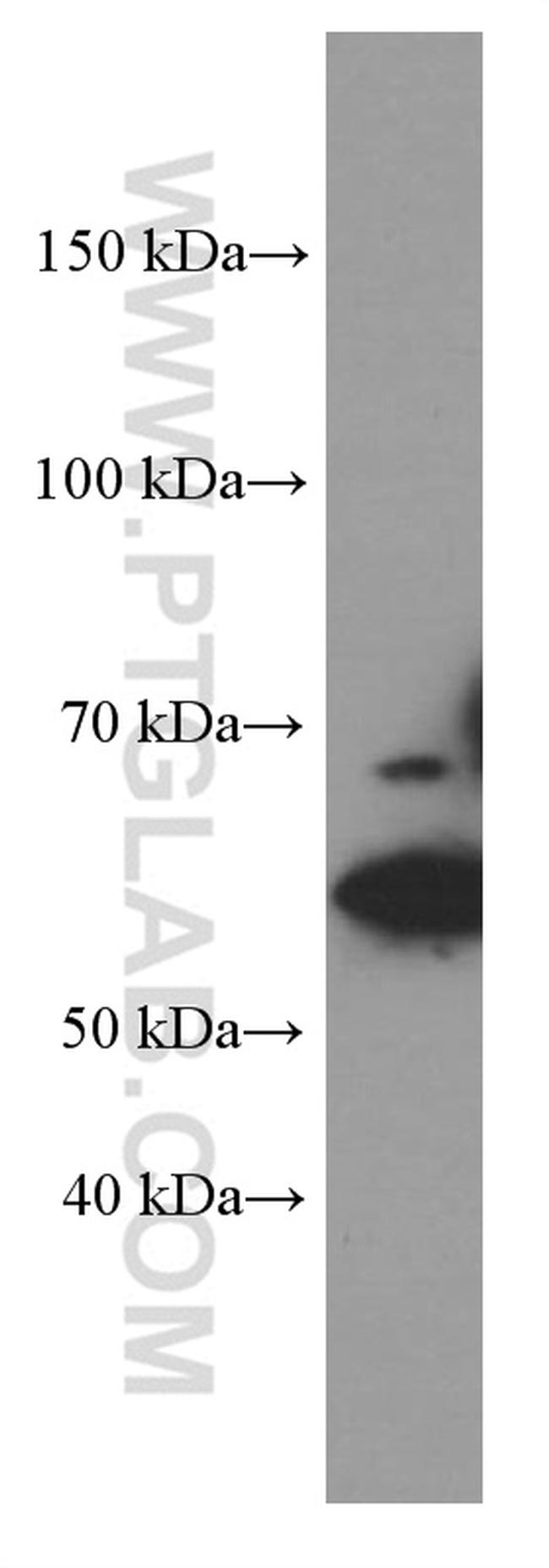 GLS Antibody in Western Blot (WB)