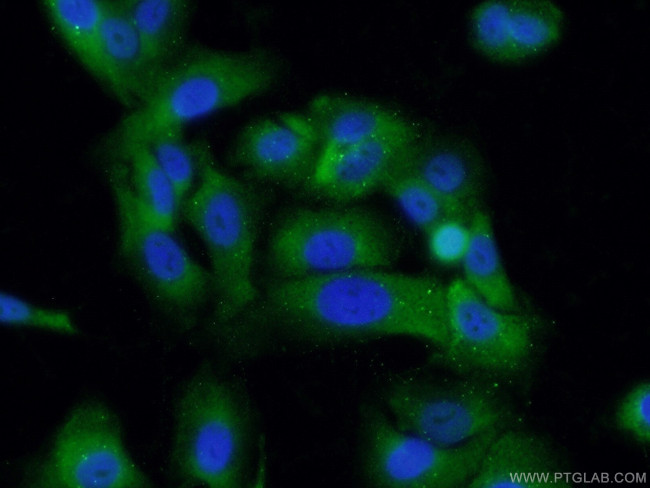 SRPX2 Antibody in Immunocytochemistry (ICC/IF)