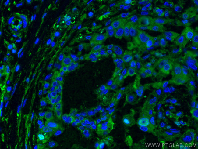 L2HGDH Antibody in Immunohistochemistry (PFA fixed) (IHC (PFA))