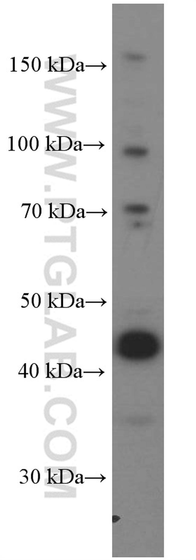 L2HGDH Antibody in Western Blot (WB)