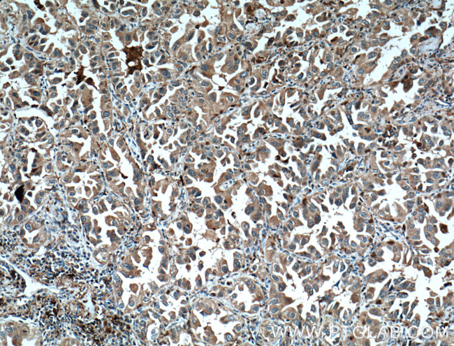 CAPG Antibody in Immunohistochemistry (Paraffin) (IHC (P))