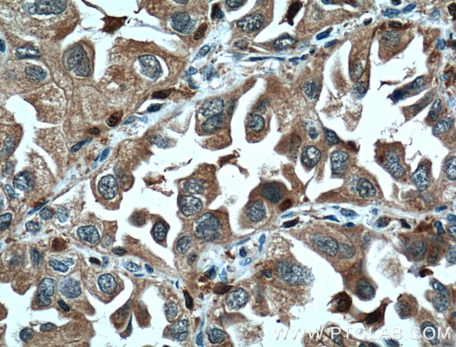 CAPG Antibody in Immunohistochemistry (Paraffin) (IHC (P))