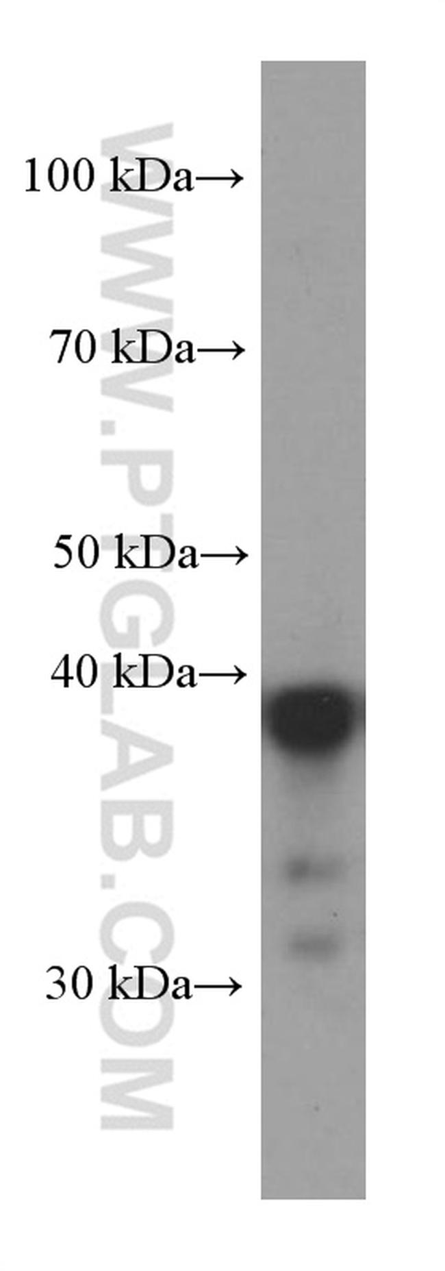 CAPG Antibody in Western Blot (WB)