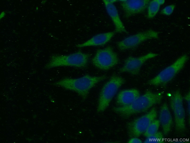 CDK6 Antibody in Immunocytochemistry (ICC/IF)