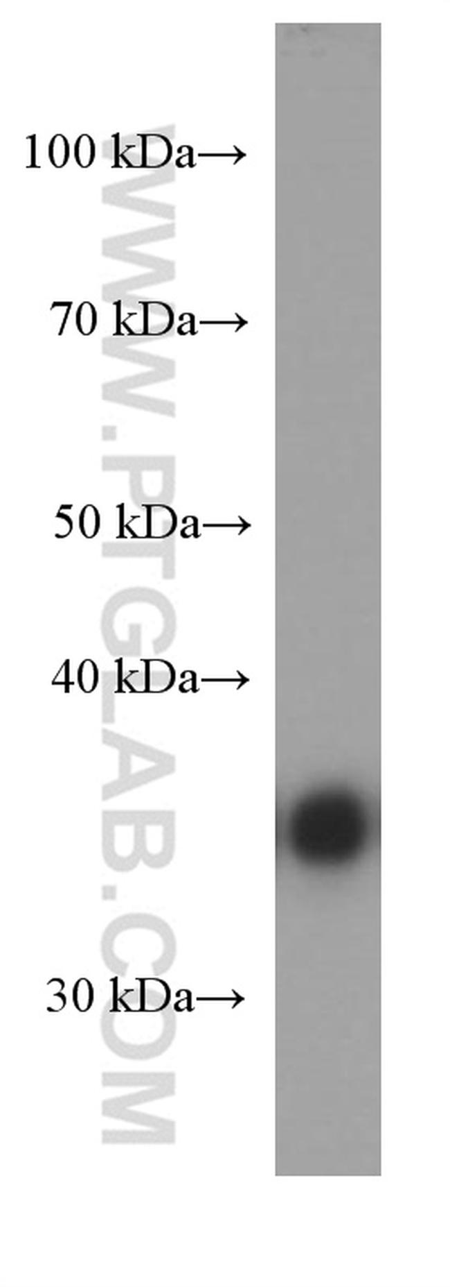 CDK6 Antibody in Western Blot (WB)