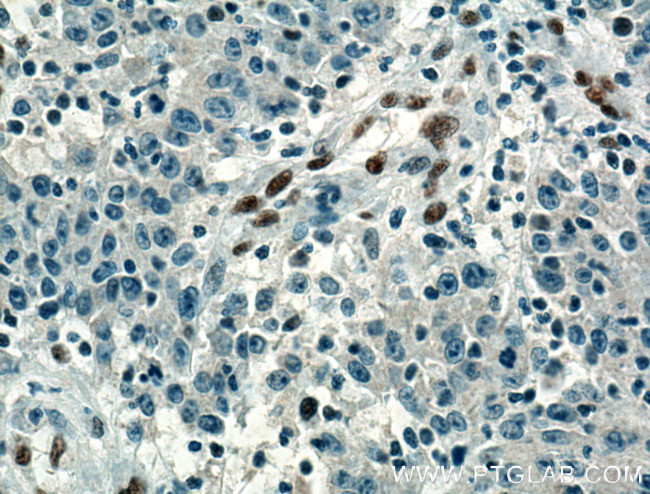 ZEB1 Antibody in Immunohistochemistry (Paraffin) (IHC (P))