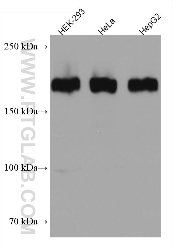 ZEB1 Antibody in Western Blot (WB)