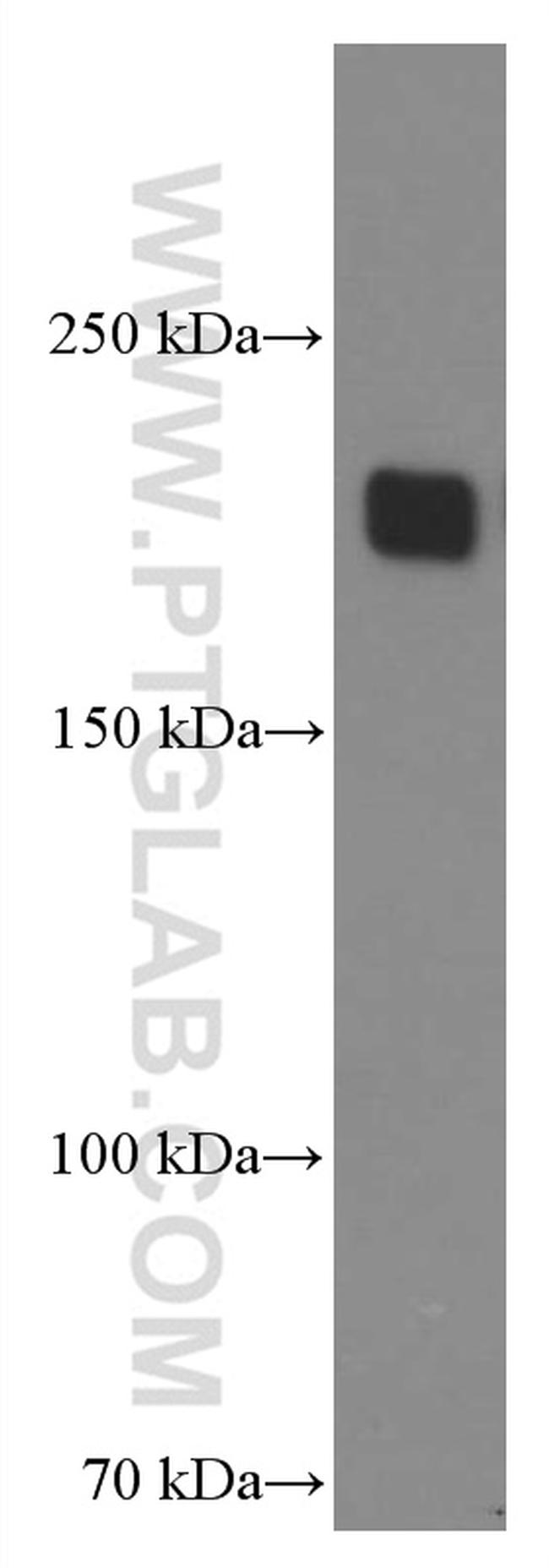 ZEB1 Antibody in Western Blot (WB)