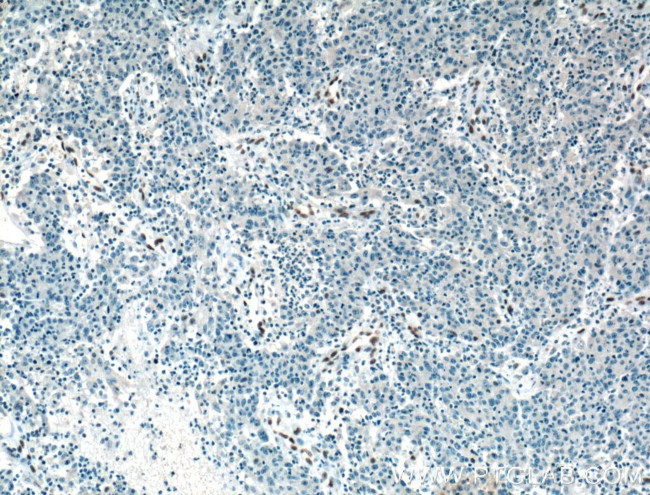 ZEB1 Antibody in Immunohistochemistry (Paraffin) (IHC (P))