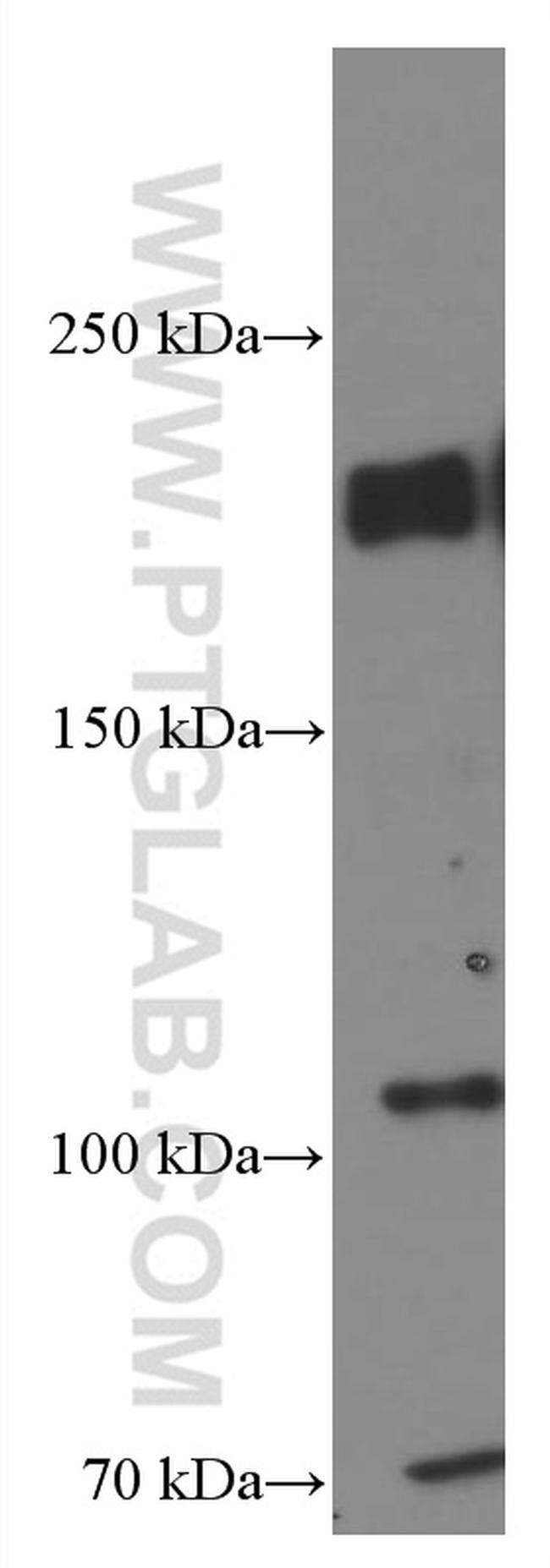 ZEB1 Antibody in Western Blot (WB)