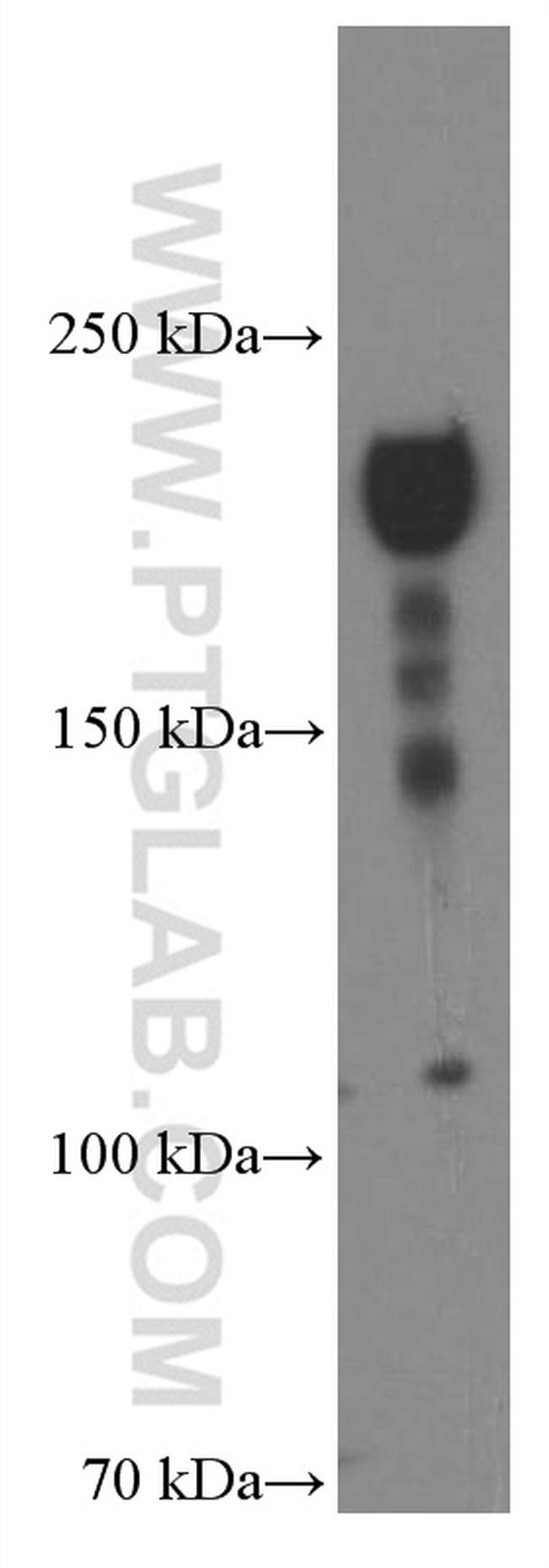 ZEB1 Antibody in Western Blot (WB)